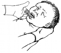 የላይኛው፡ስዕል: