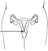 a woman's torso with reproductive organs shown and an arrow to "cervix".
