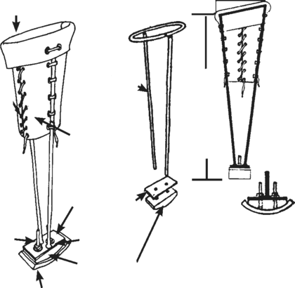 Three pictures showing the different parts of a leather metal and rod limb, with arrows on each signaling measurements, characteristics, materials used.