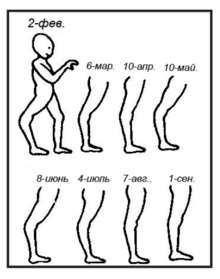 monthly record of a child's leg