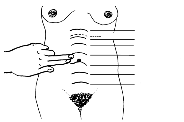 marque toutes les 2 largeurs de doigts en descendant l'abdomen d'une femme; le nombril est à environ 5 mois.'s abdomen; the bellybutton is at about 5 months.