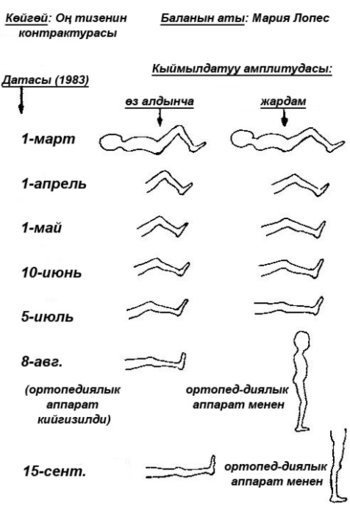 a record of a knee contracture