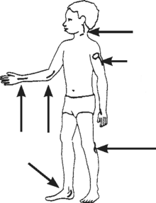 A boy standing with arrows pointing to places that can be checked for large nerves