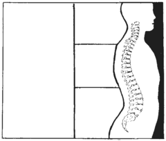 una columna vertebral normal