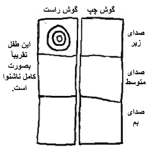 A chart with 3 sections for each ear (low pitch, middle pitch, high pitch)and a mark in only 1 section.