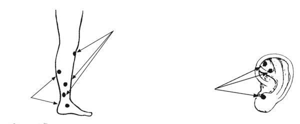 pressure points indicated below on the inner leg: upper shin, mid-calf, above the ankle, and side of the foot; pressure points on the earlobe and upper front of the outer ear