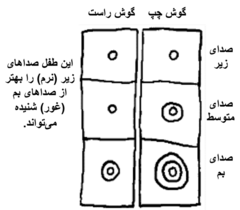 A chart with 3 sections for each ear (low pitch, middle pitch, high pitch)and different-sized marks in each section.